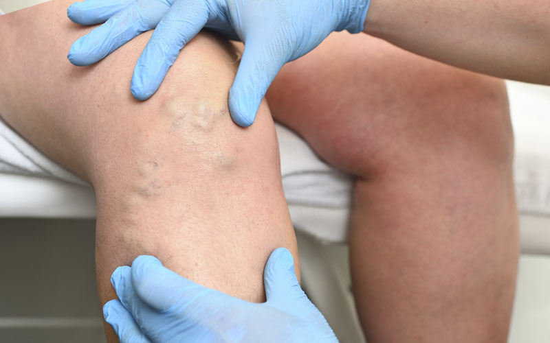 Istituto di Radiologia e Terapia Fisica Dr. Cicìo - Visita Angiologica